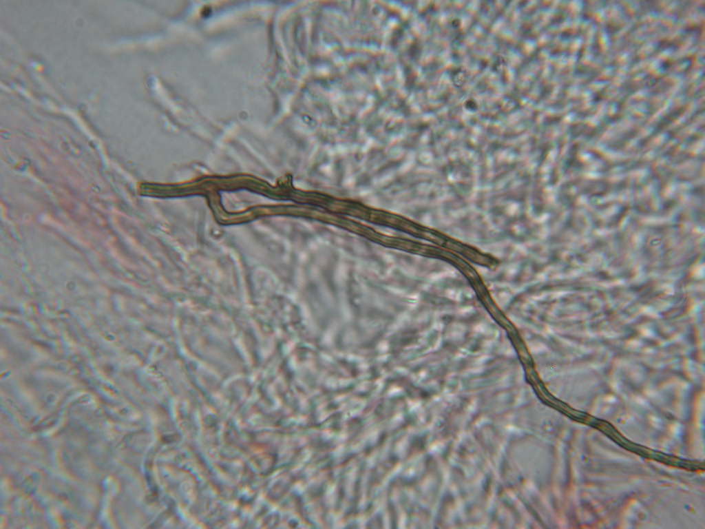 Da determinare...  (Dacryobolus karstenii)